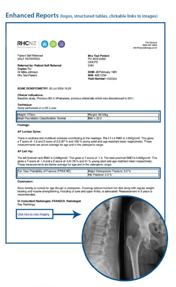 New Report structure